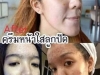 ★★★ HOT!! ครีมลูกปัด เผยหน้าขาวใสไร้สิว สิวยุบแห้งไว จุดด่างดำหายเกลี้ยง Lookpat